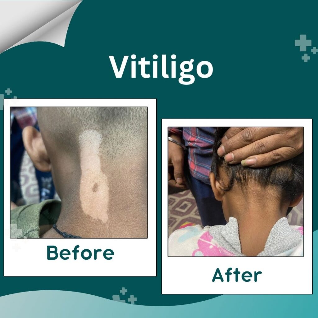 Before & After Treatment