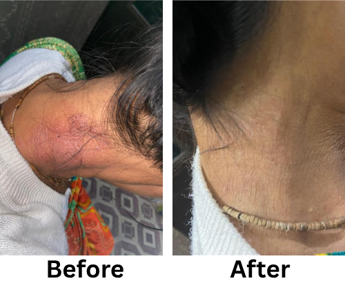 Before After_1