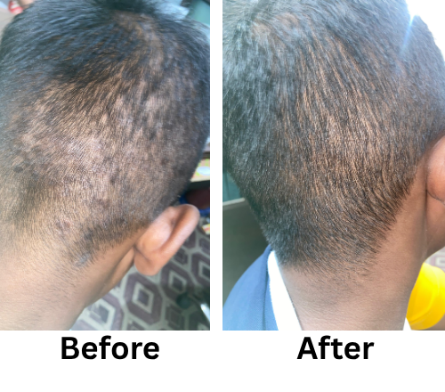 Before After_12