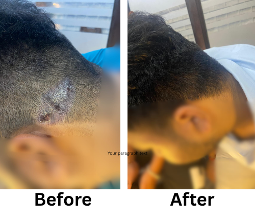 Before After_123